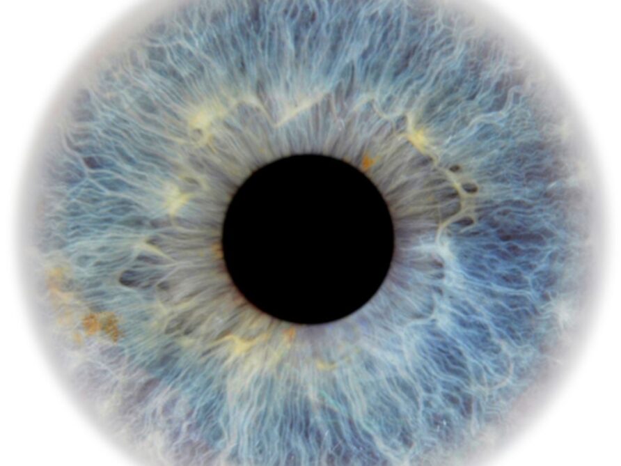 How Vision Can Signal Other Health Problems